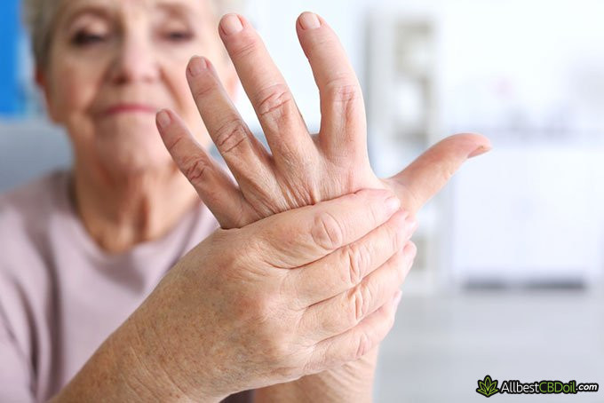 CBG vs CBD: arthritis